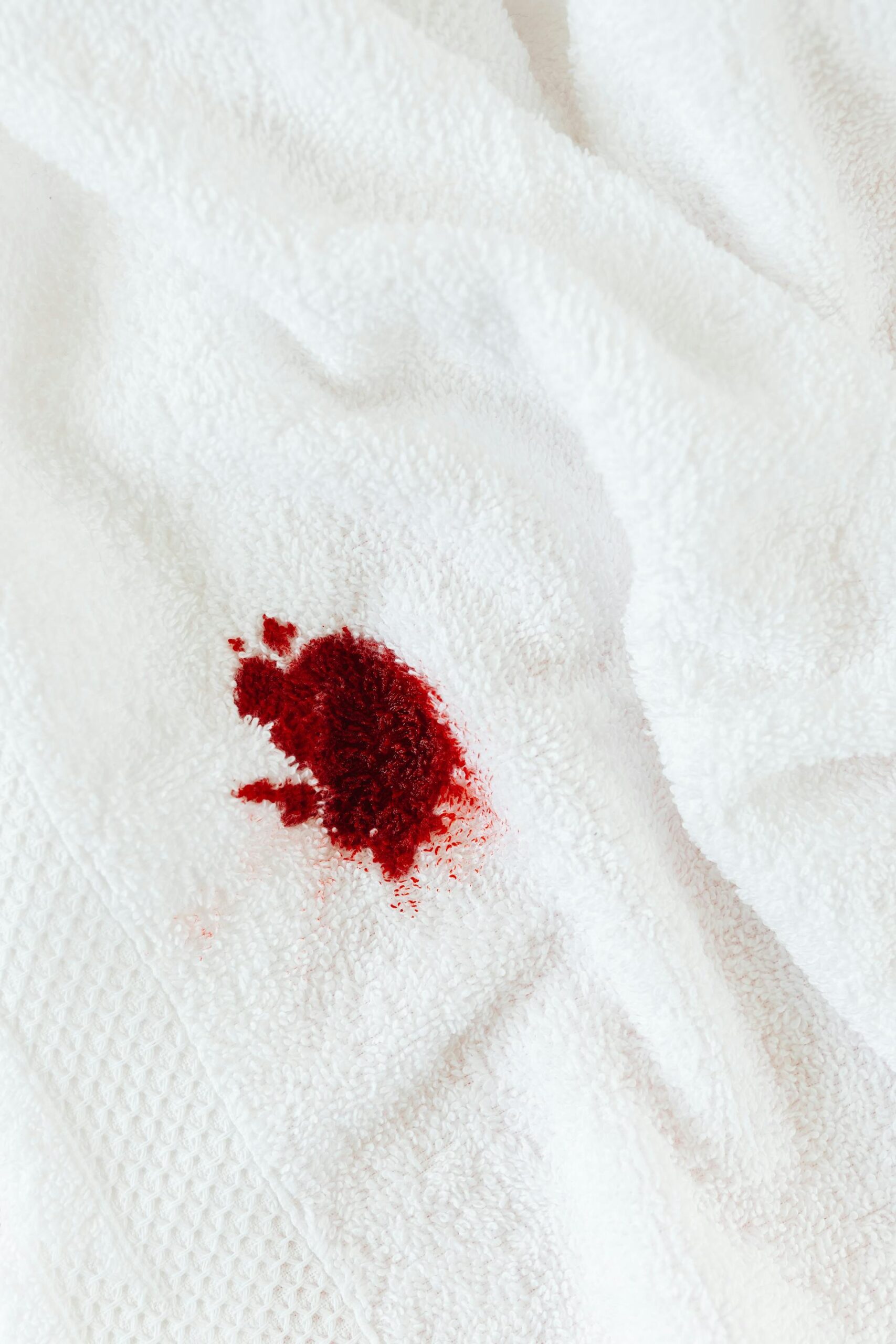 How to Get Blood Out of Clothes: 5 Proven Methods You Haven’t Tried