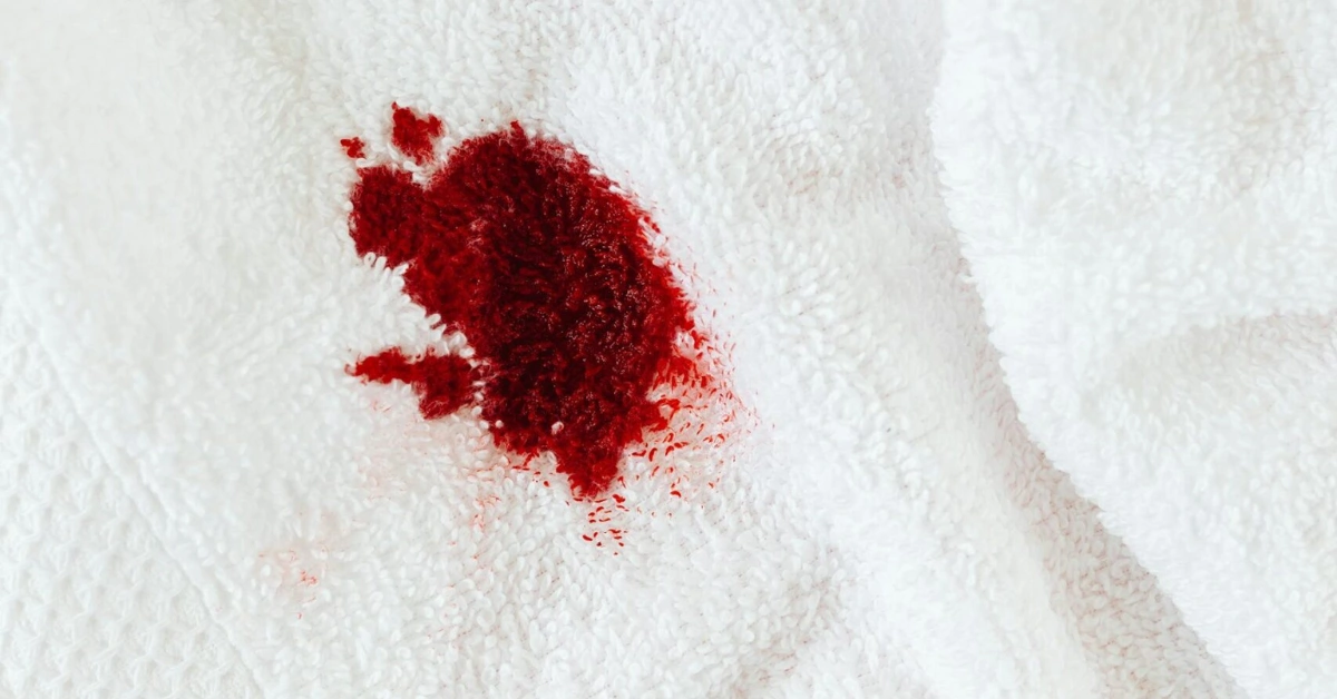 how-to-remove-blood-stain-clothing-tutorial