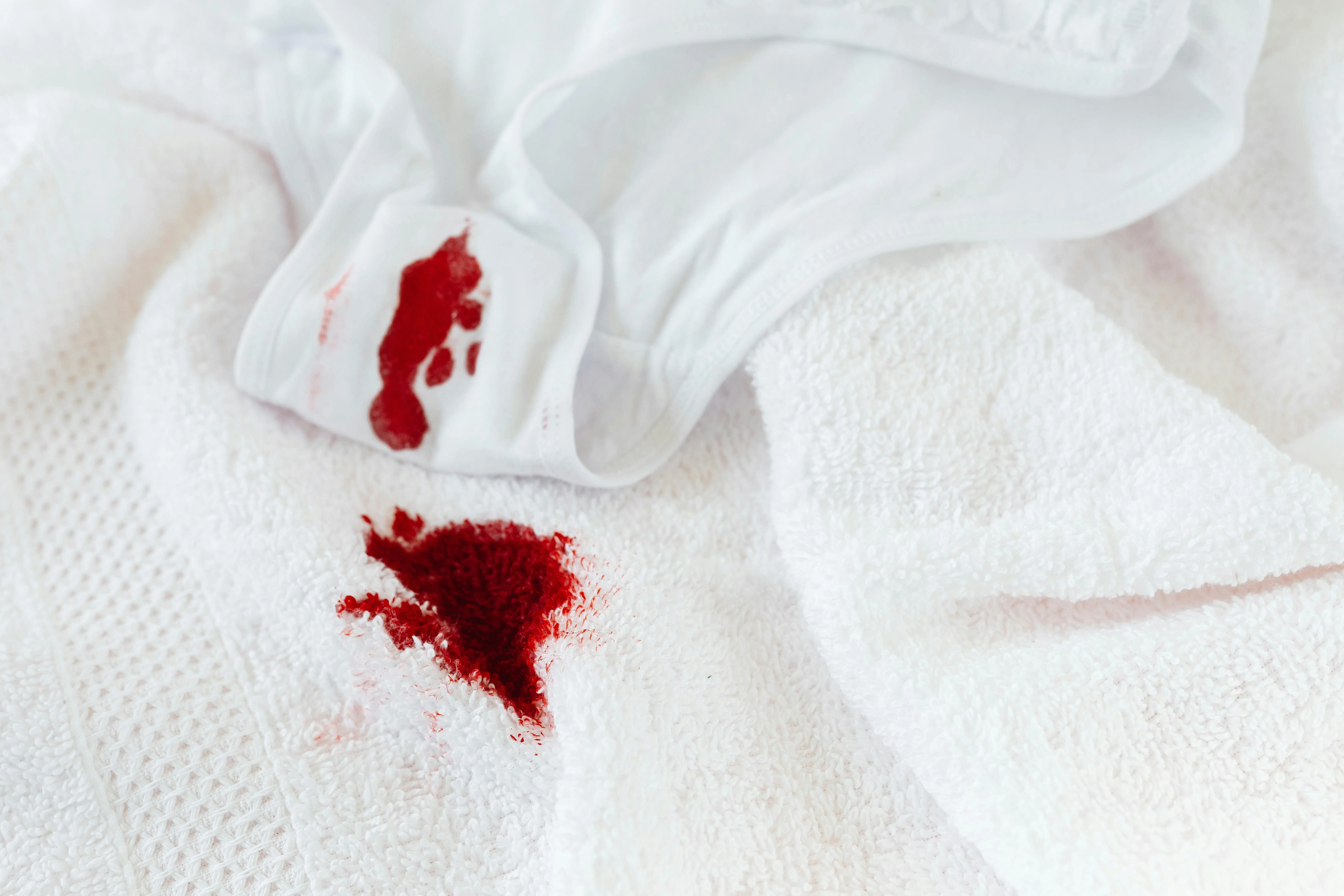 how to get blood out of jeans Close-up of white underwear and towel with visible menstrual blood stains.