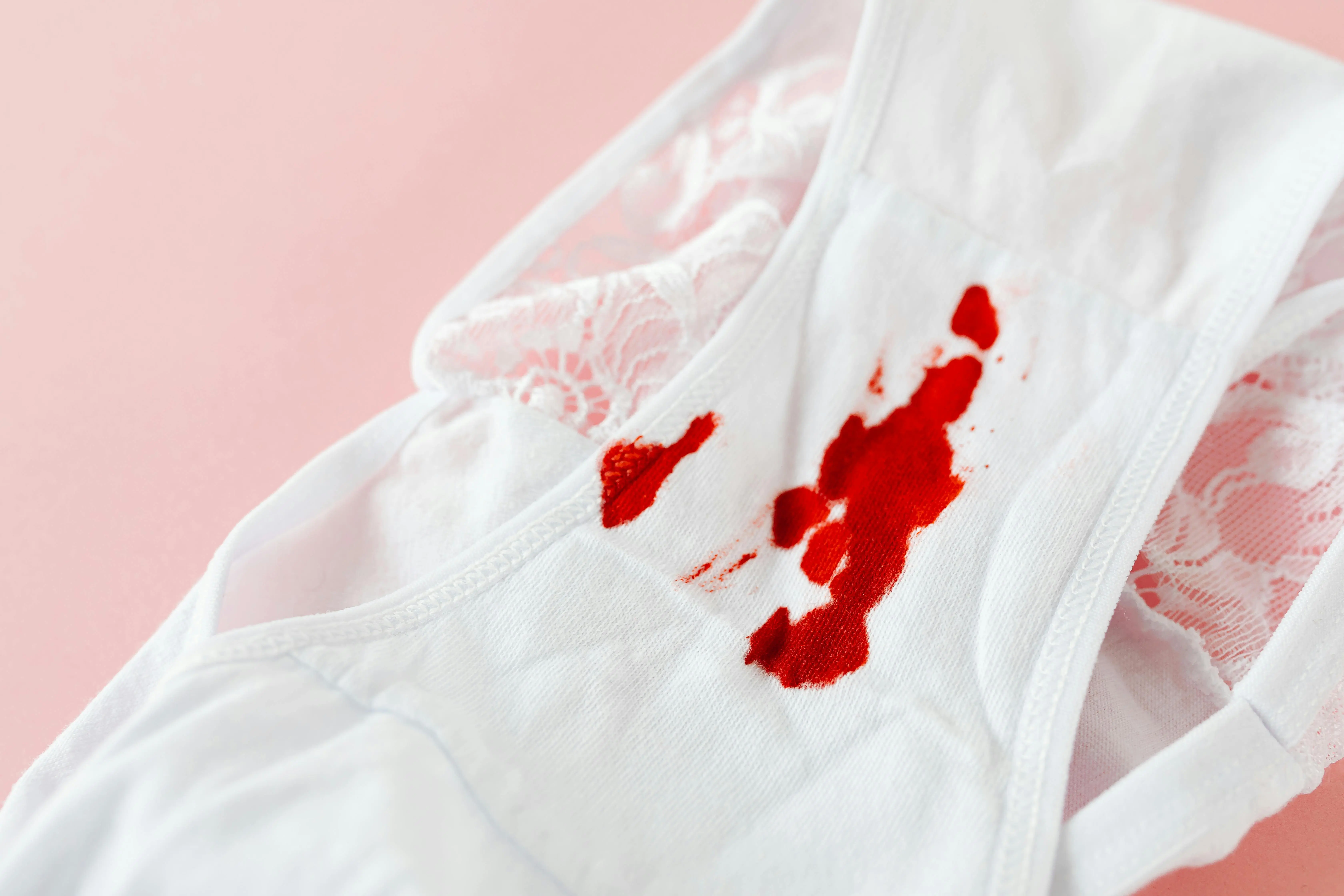 how to get deodorant stains out of black shirts Detailed image of menstrual blood stains on white lace underwear against a pink background.