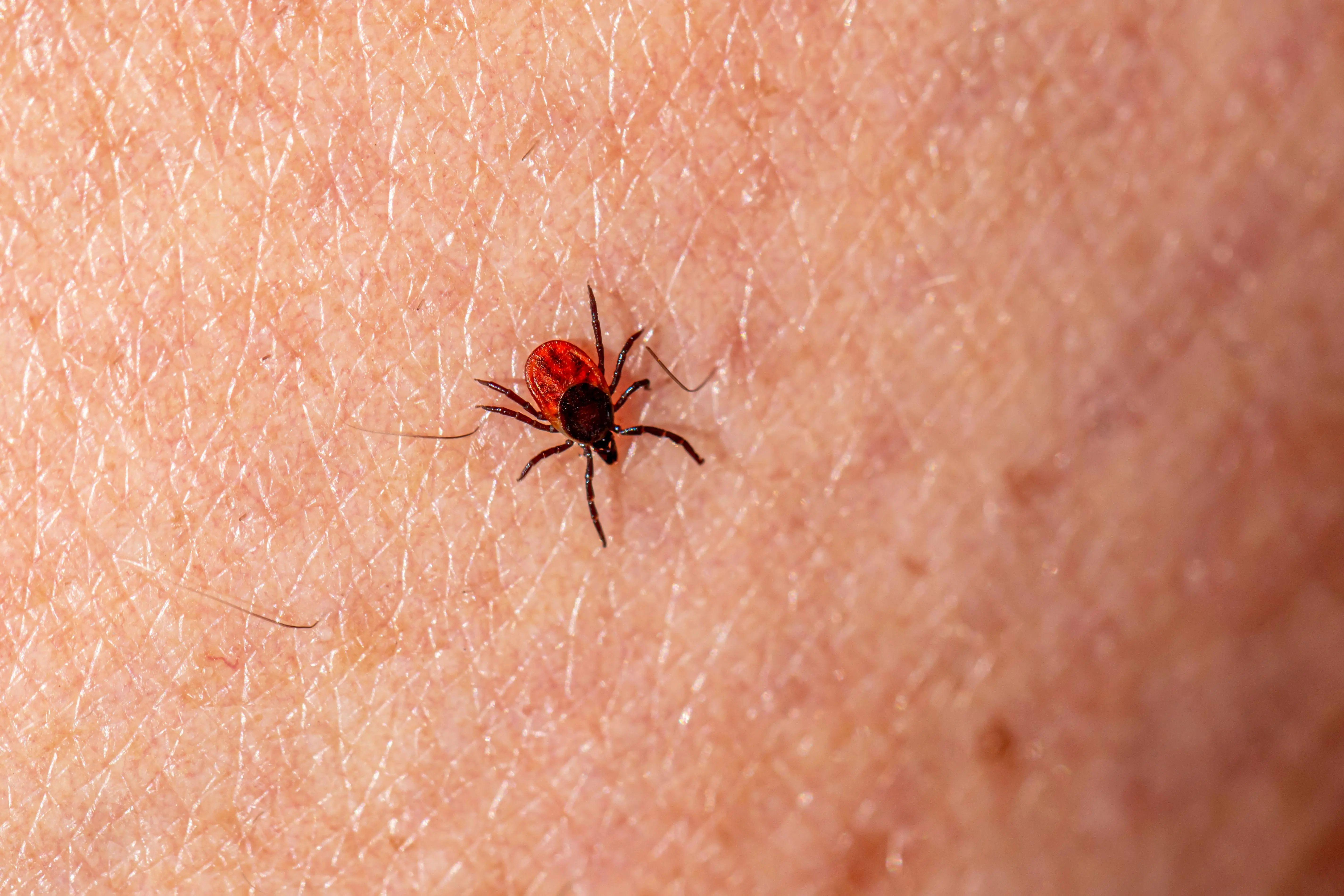 little black bugs Macro photograph showing a deer tick (Ixodes scapularis) on human skin, highlighting pest detail.