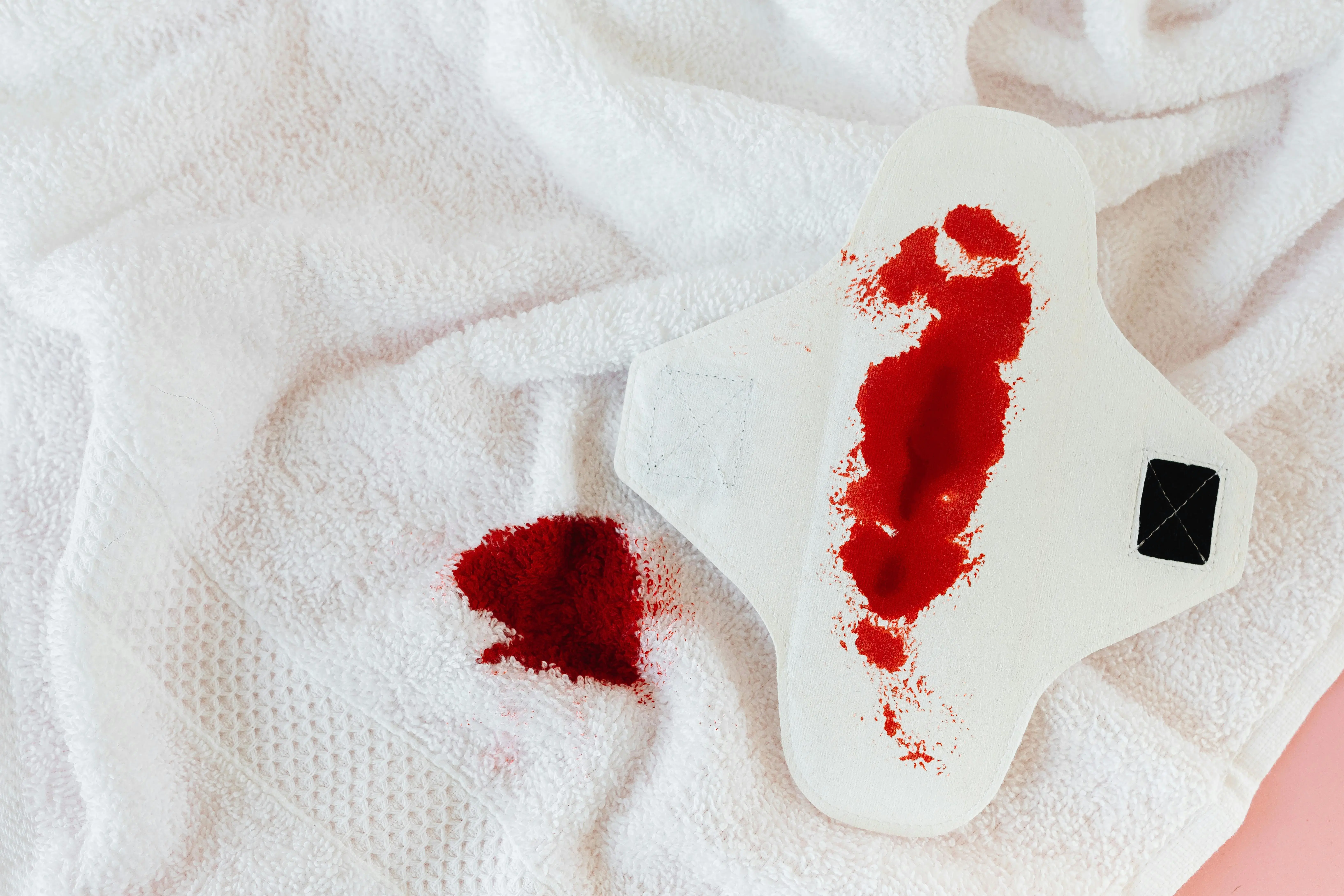 get blood out of clothes Close-up of a white sanitary napkin with menstrual blood on a towel, highlighting femininity and hygiene.