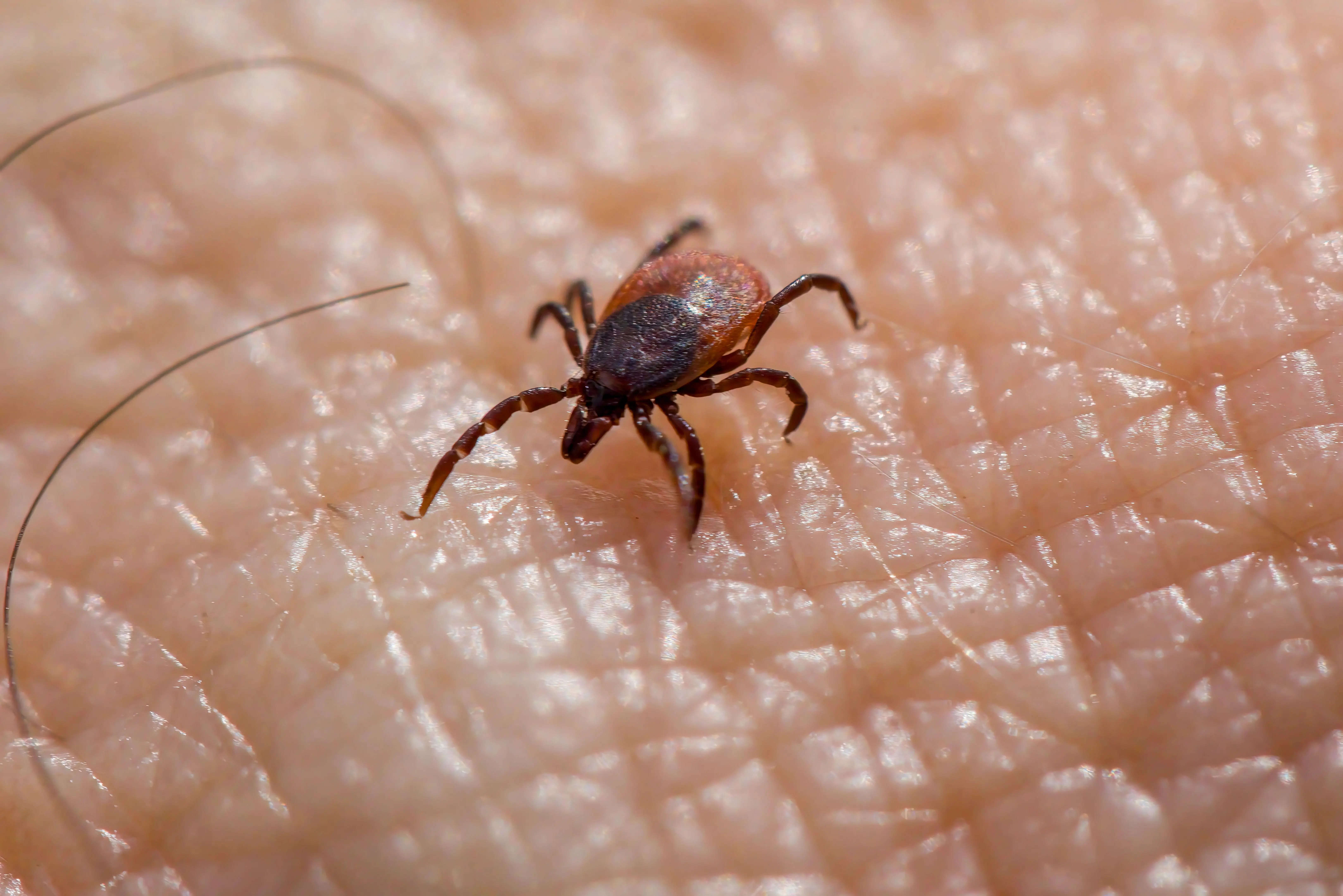 spiders in texas Macro image of a tick on human skin, highlighting the risk of Lyme disease.